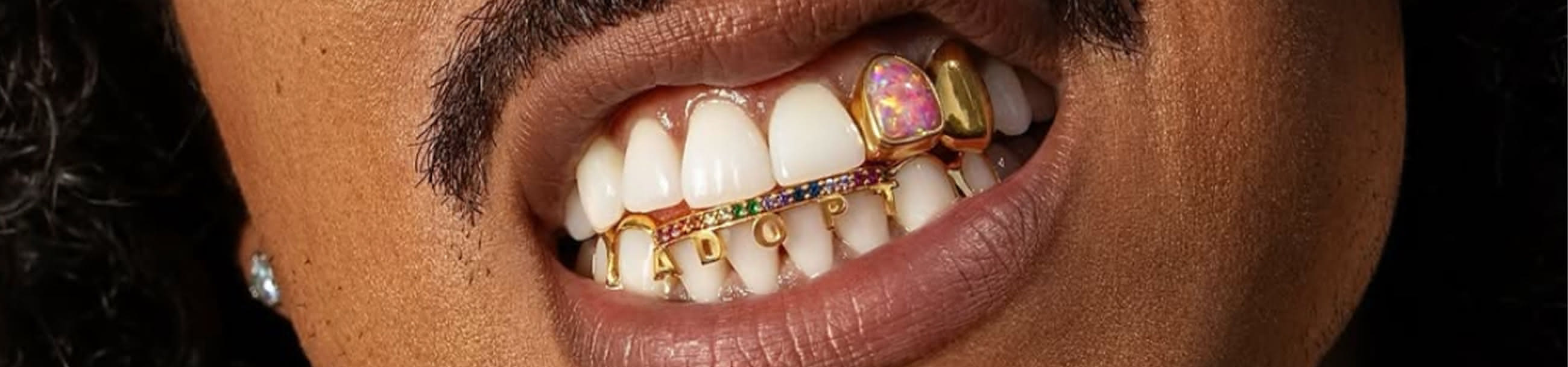 Custom gold bottom grillz spelling "ADOPT" with rainbow gemstone bar, paired with a gold opal single crown on a top tooth
