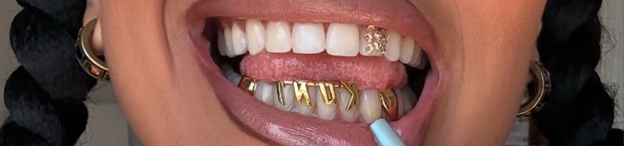 Gold bottom grillz with a custom name in gothic script, complemented by a diamond-set single crown on a top tooth