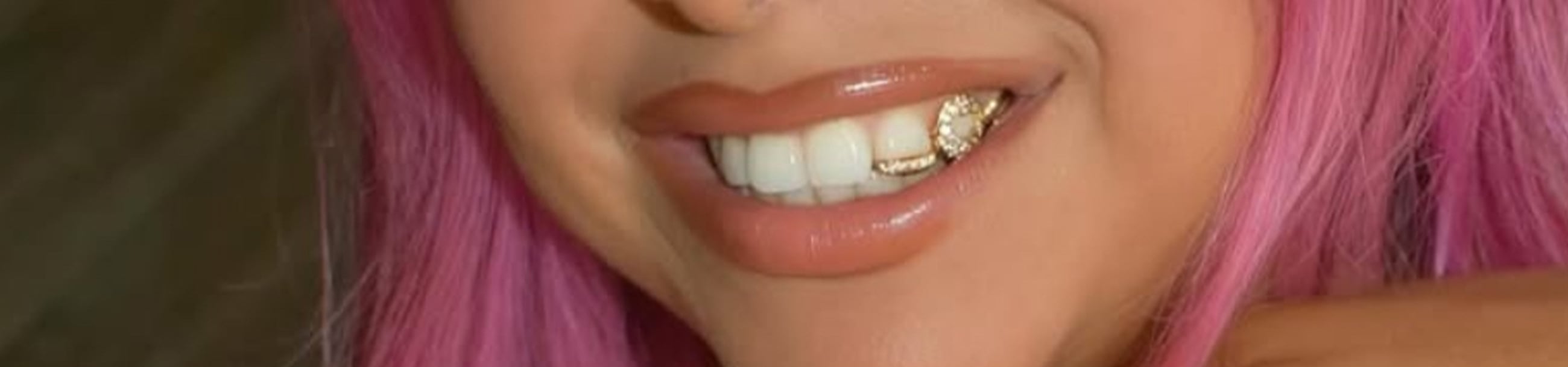 Single gold upper tooth cap with pavé diamond setting, worn with a natural smile and pink hair