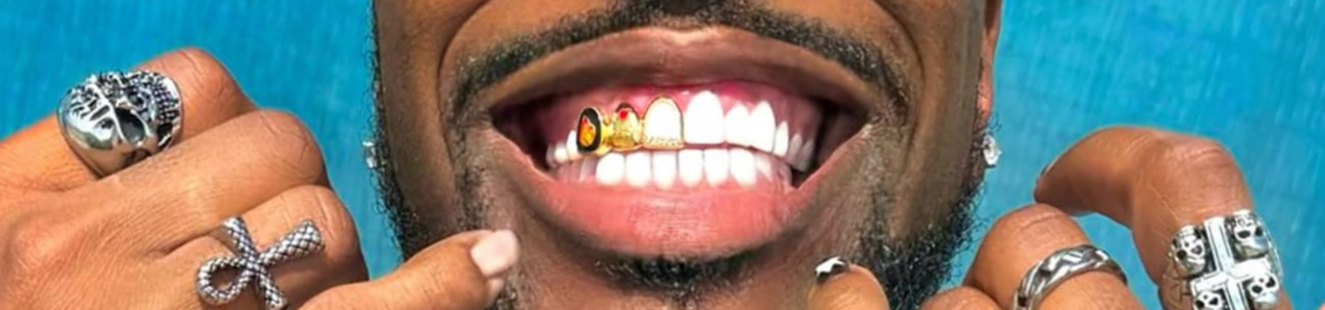 Single gold tooth cap with a fire opal gem against a bold smile, hands framing the face in silver statement rings