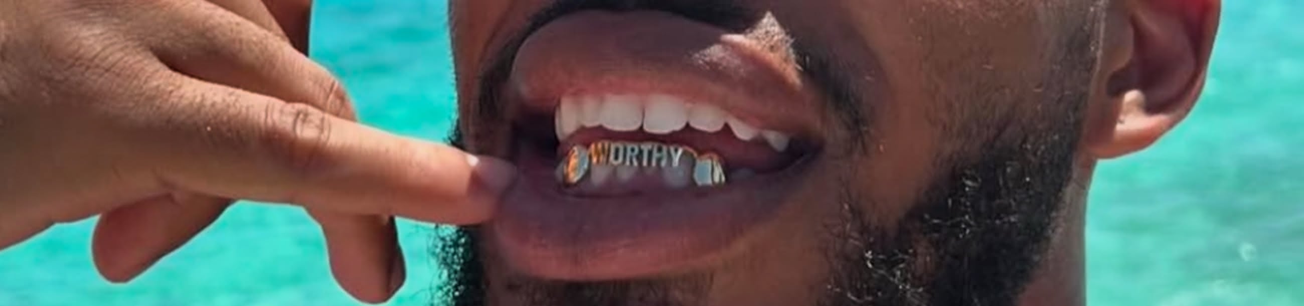 Gold bottom grillz spelling "WORTHY" in raised lettering, pointed out while smiling outdoors near water