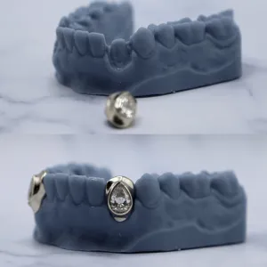 Custom pear-shaped diamond bezel permanent crown on a lower canine tooth with gold adjacent crowns, shown before and after on a dental cast