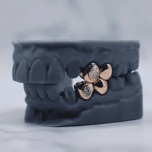 Two custom rose gold single-tooth crowns with bezel-set oval diamonds shown side by side on upper and lower positions of a closed dental cast