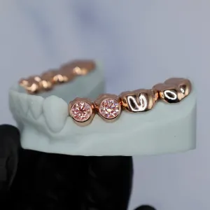 Custom rose gold permanent crown set for the upper arch, with bezel-set round pink diamonds on the two central incisors and engraved detailing on adjacent crowns, shown from the front on a white dental model