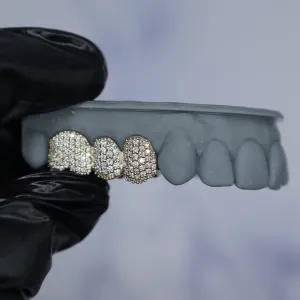 Three custom pavé diamond dome single-tooth crowns shown together on a dental cast: two white gold and one yellow gold, each fully set with round brilliant diamonds