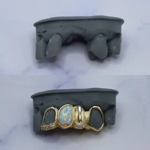 Custom gold grillz with an oval opal center stone and pavé diamond accents, filling two missing lower canine gaps — shown before and after on a dental cast
