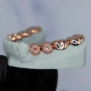 Custom rose gold permanent crown set for the upper arch with bezel-set round pink diamonds on the central incisors, shown from a side angle on a white dental model